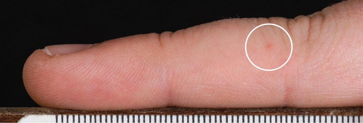 Rabid bat found in Teton County Health