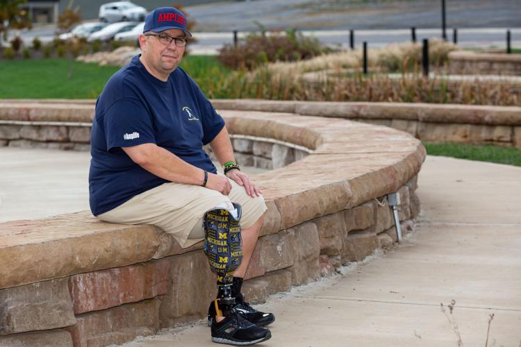 After losing leg, area man looking to provide support, resources for other amputees
