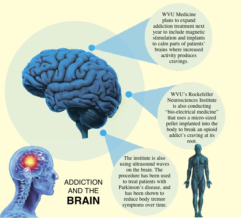 Brain Work: Researchers Focus In On Neurological Side Of Substance ...