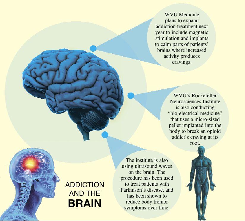 Brain work: Researchers focus in on neurological side of substance ...