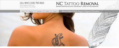 NC Tattoo Removal