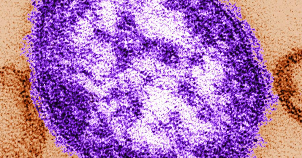 Texas Faces Measles Surge Amid Vaccine Misinformation Crisis