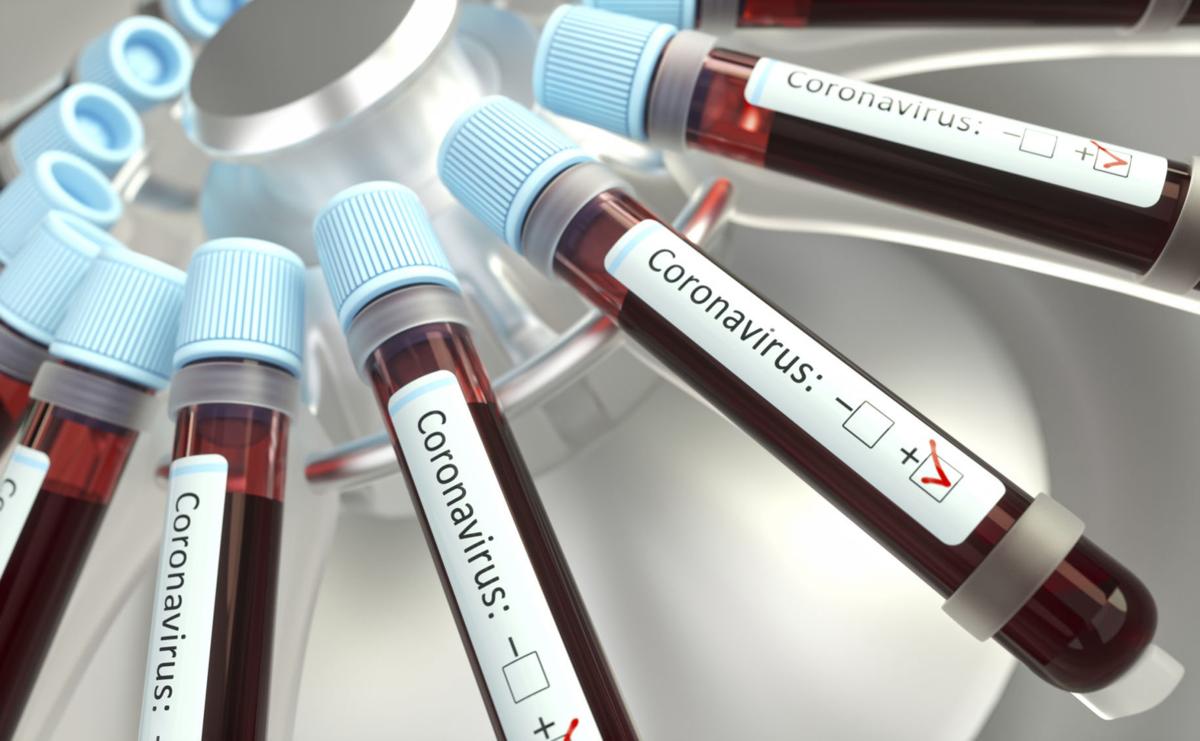 Coronaviruses research, conceptual illustration. Vials of blood in a centrifuge being tested for coronavirus infection.conceptual illustration
