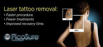 Faster Tattoo Removal Procedure