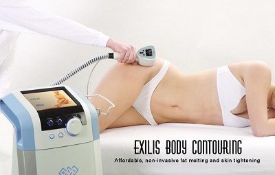 Exilis Body Contouring Treatment