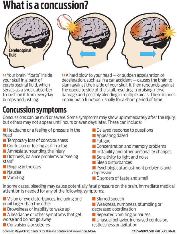 Head injury common among children in sports