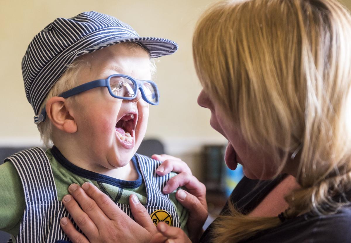 The Oldest Son In A Winston Salem Family Was Born With A Rare Genetic Disorder Called Apert Syndrome This Is Cam S Story Z No Digital Journalnow Com
