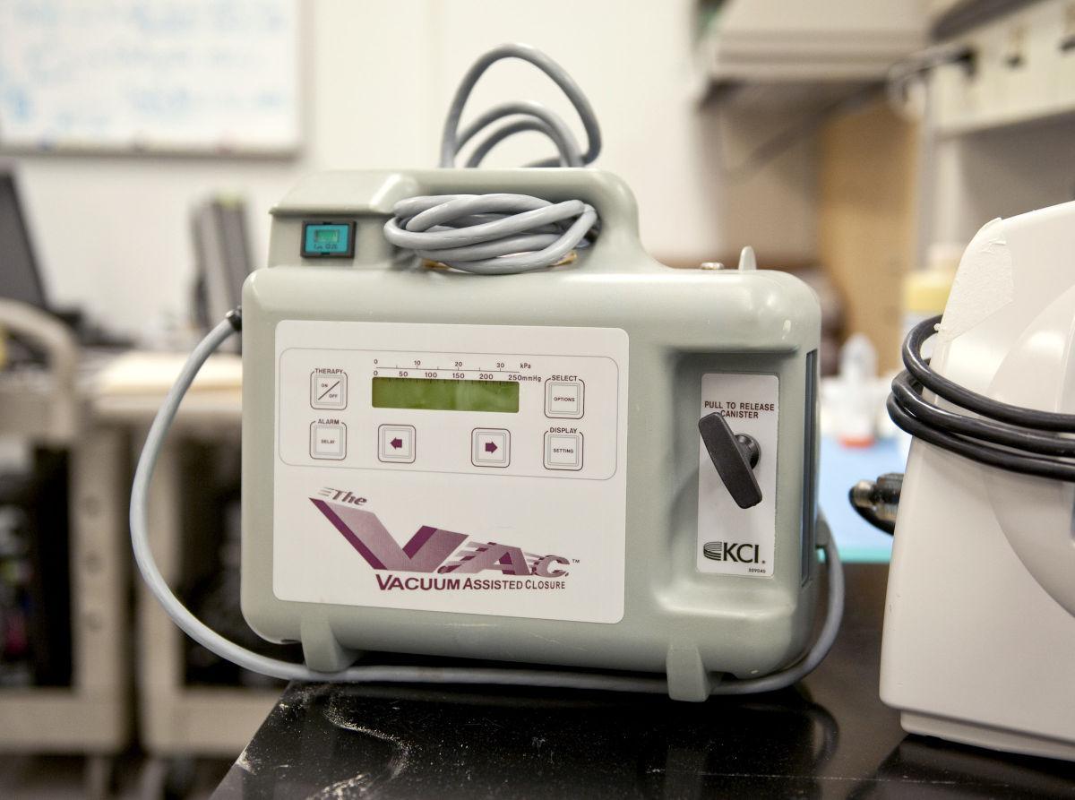 WinstonSalem doctor receives award for device that helps wounds to heal Business News