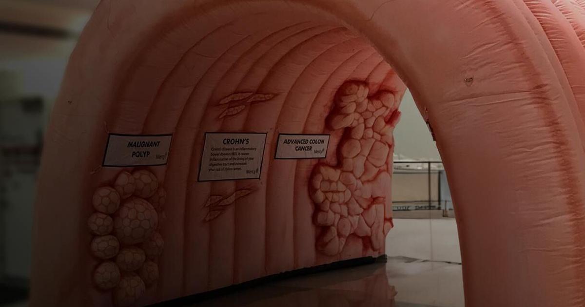 Inflatable Colon For Learning Killeen health fair to feature walk-through, inflatable colon | Local ...