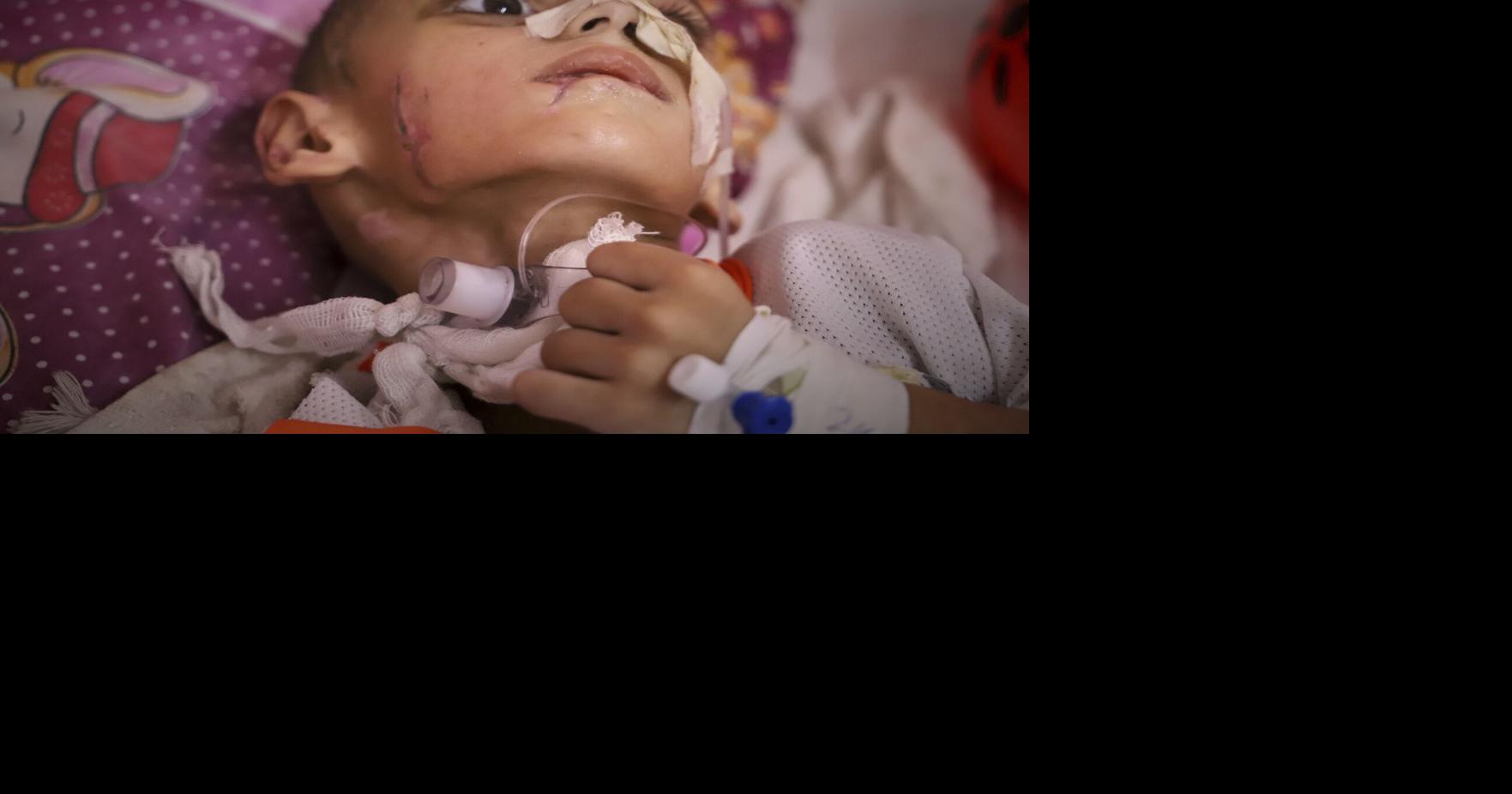 A boy with a brain injury fights for his life in Gaza's decimated health system