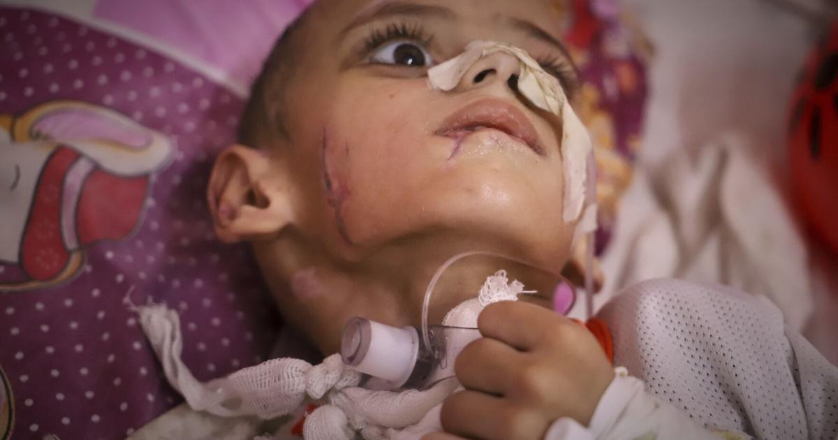 A boy with a brain injury fights for his life in Gaza's decimated health system