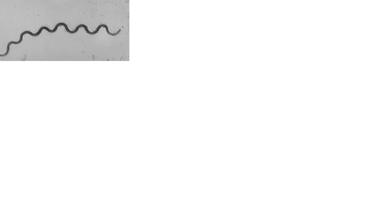 Syphilis rates surging across Oregon - Vimarsana News