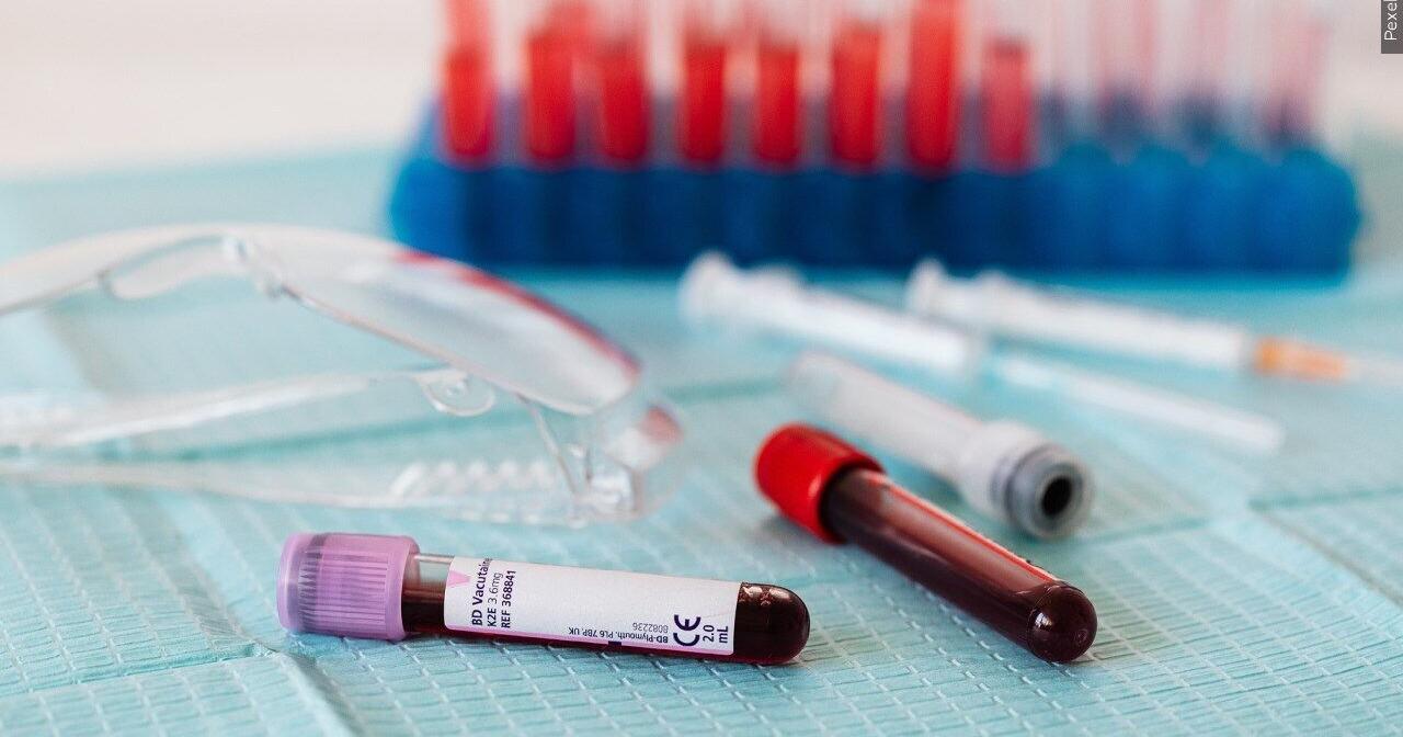 Local health clinics, nonprofits encourage HIV testing during Pride Month - Vimarsana News