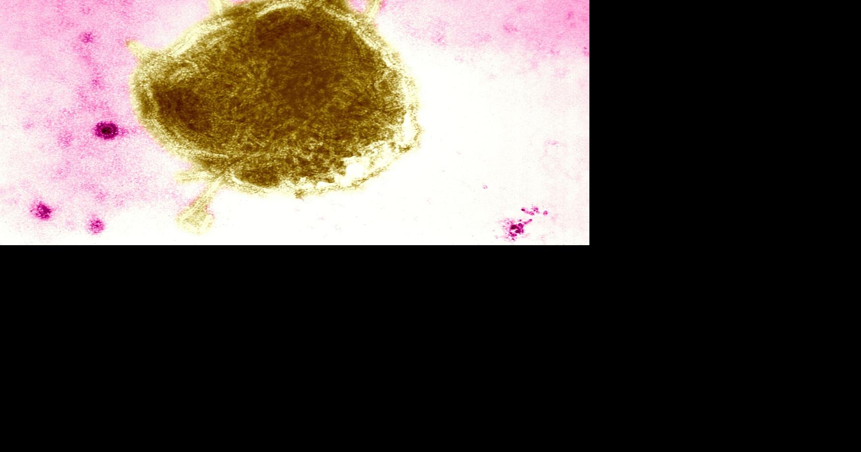 Oregon Health Authority confirms first measles case of 2026