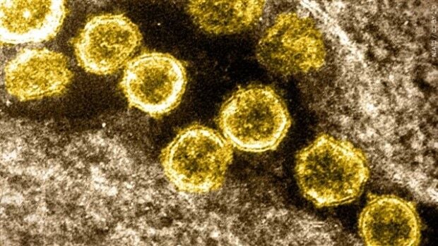 Coronavirus Watch: Oregon orders 12 million at-home COVID-19 tests for free distribution