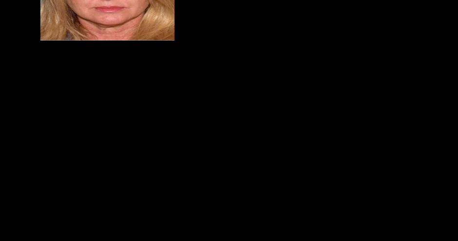 Police searching for missing woman in Siskiyou County - Vimarsana News