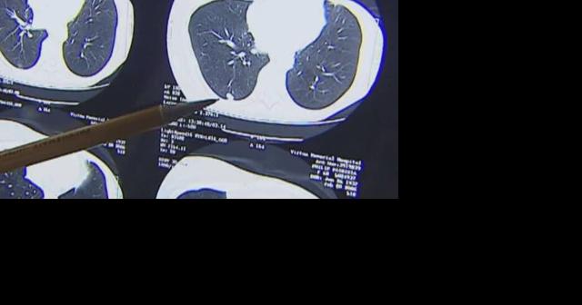 OSU research working towards new therapy for pancreatic cancer - Vimarsana News