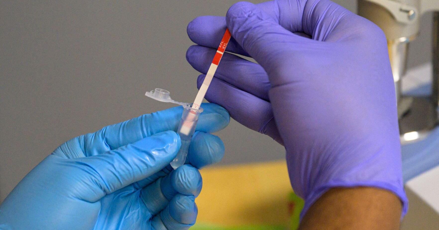 Xylazine present in more than 1 in 10 fentanyl overdose deaths in the US - Vimarsana News