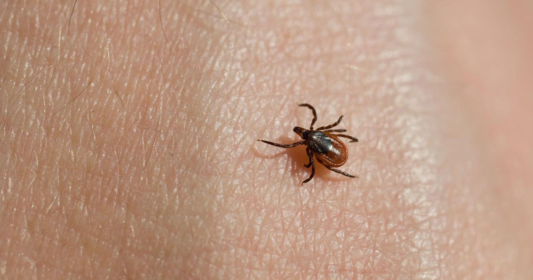 This could be the peak of tick season – and tick-borne diseases are on the rise - Vimarsana News