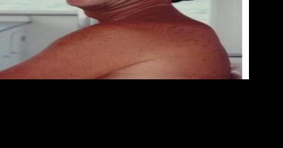 Harvey Franklin Watkins - Vimarsana News