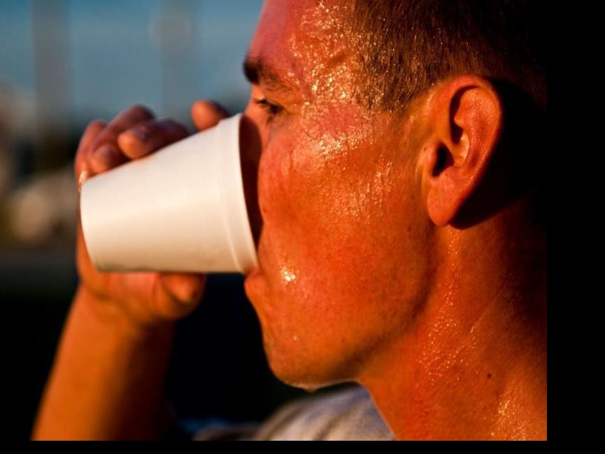 extreme sweating