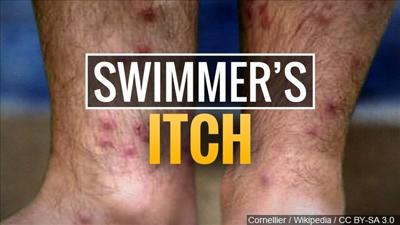 itch swimmer khq