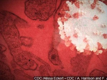 Health District Number Of Mumps Cases Up To 191 In Spokane News Khq Com Health District Number Of Mumps Cases Up To 191 In Spokane News Khq Com