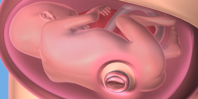 Cleveland Clinic Performs Its First Successful In Utero Spina