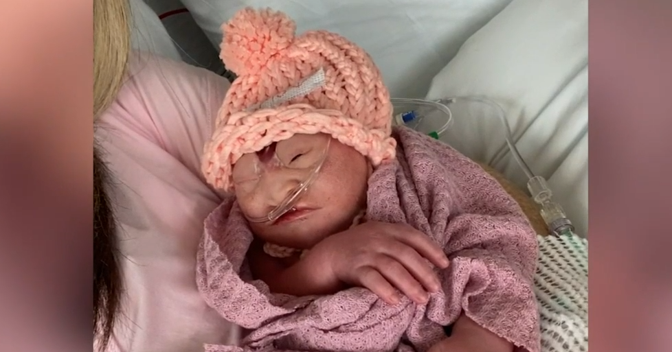 Airway Heights family shares child's serious birth defect diagnosis of ...