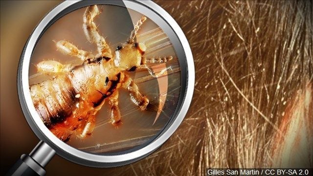 Expert Check For Lice In Halloween Costumes News Khq Com