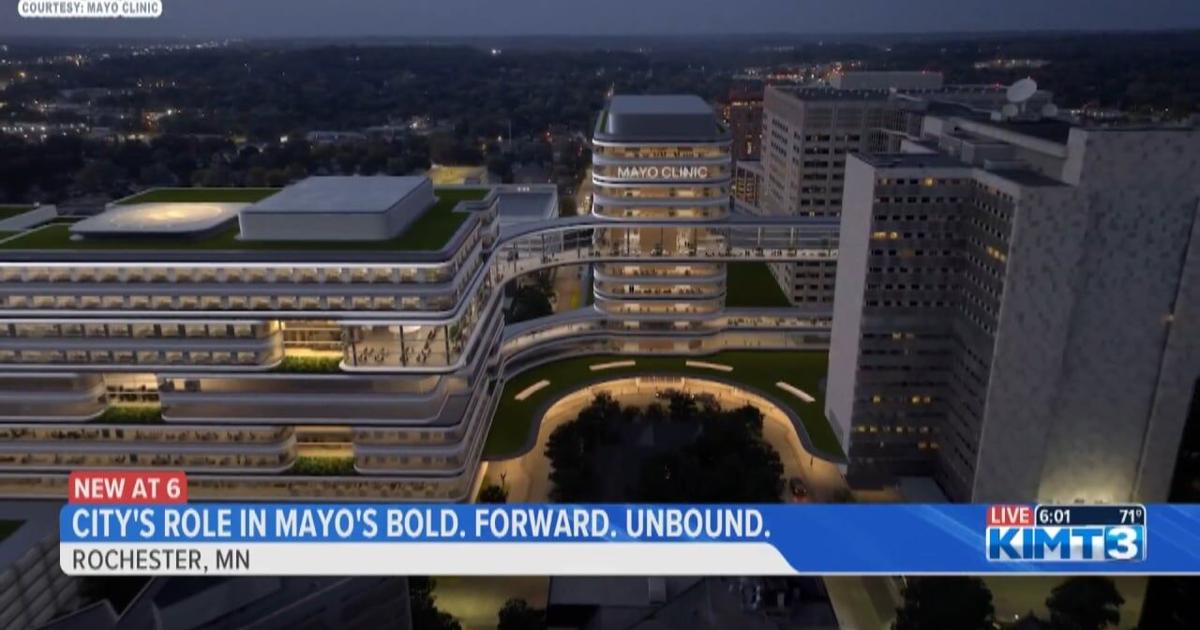 City Of Rochester Explains Role In Mayo s Bold Forward Unbound City of rochester explains role in mayo s bold forward unbound