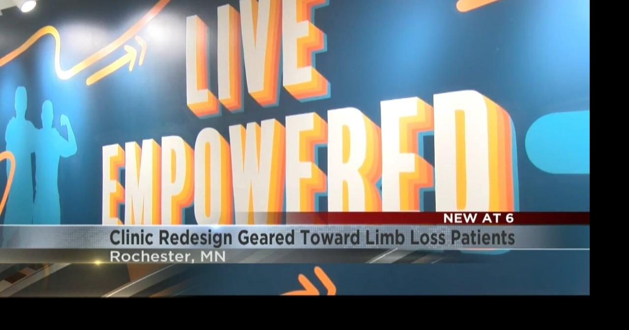 Rochester clinic redesign is geared toward limb loss patients | News ...