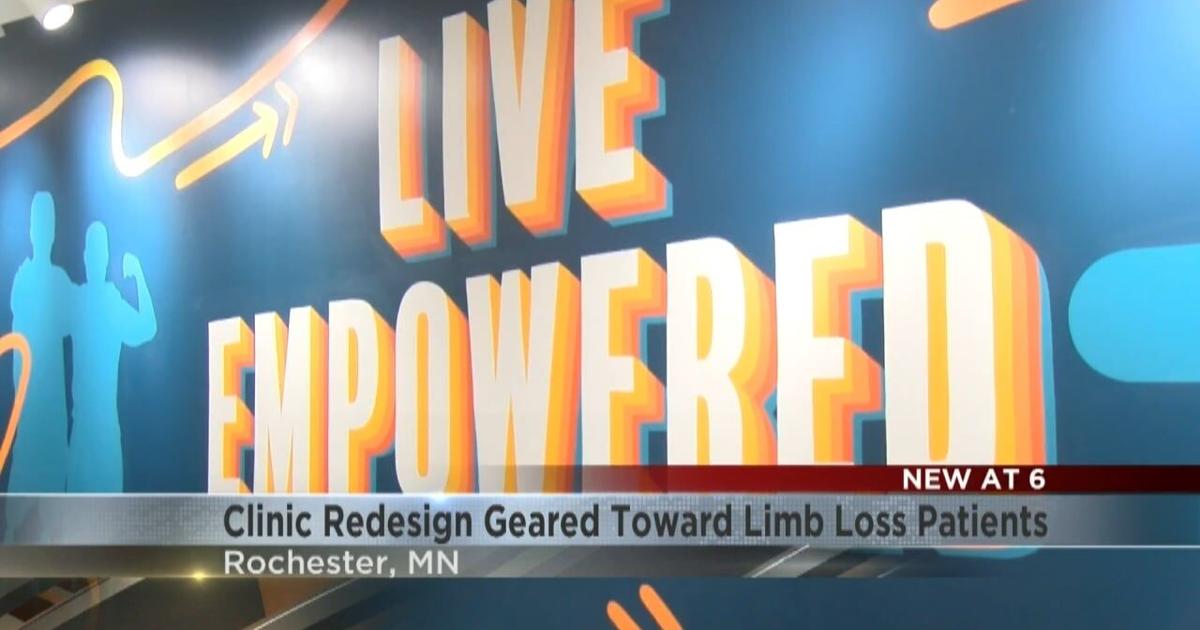Kimt Rochester Rochester clinic redesign is geared toward limb loss patients | News ...