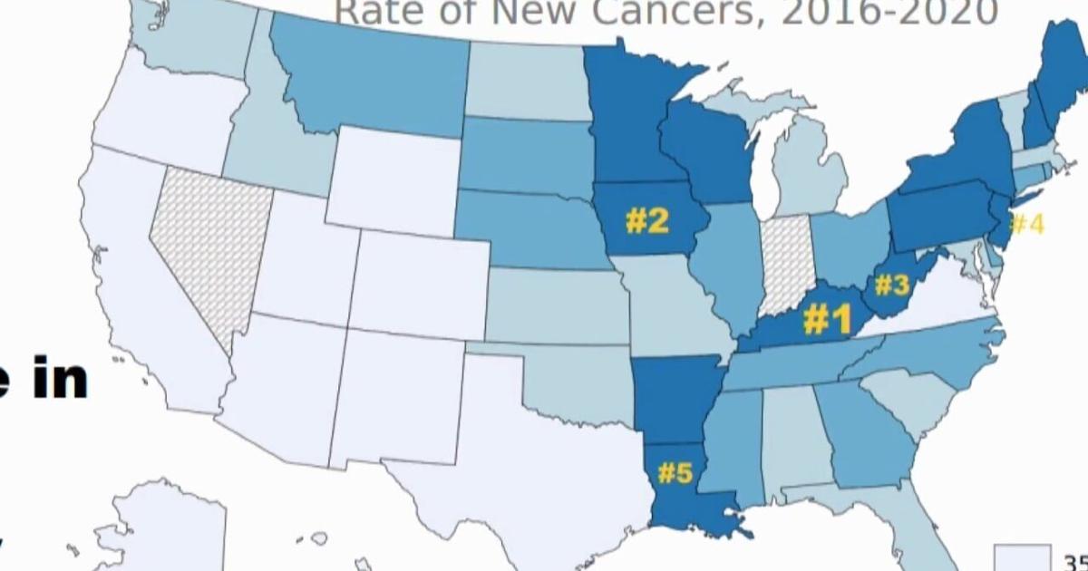 Iowa Cancer Rates Confronting Cancer: Iowa Ranks 2nd in Nation for New Cancer Cases ...