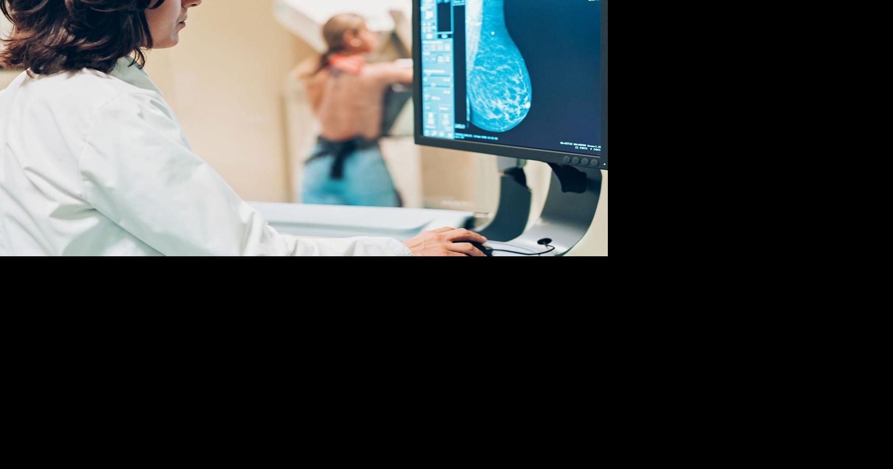 Missing the first mammogram linked to increased risk of breast cancer ...