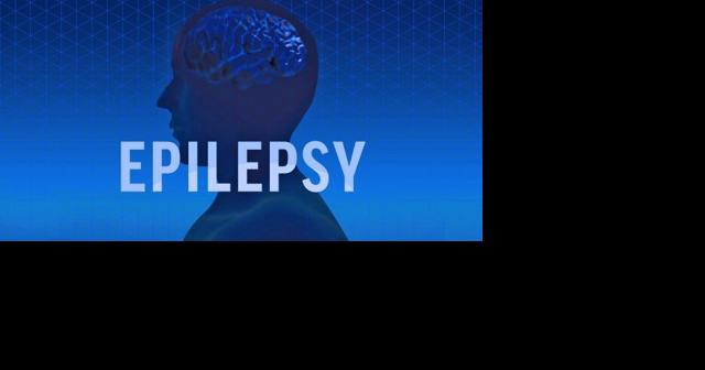 Mayo Clinic doctor recognized for epilepsy research - Vimarsana News