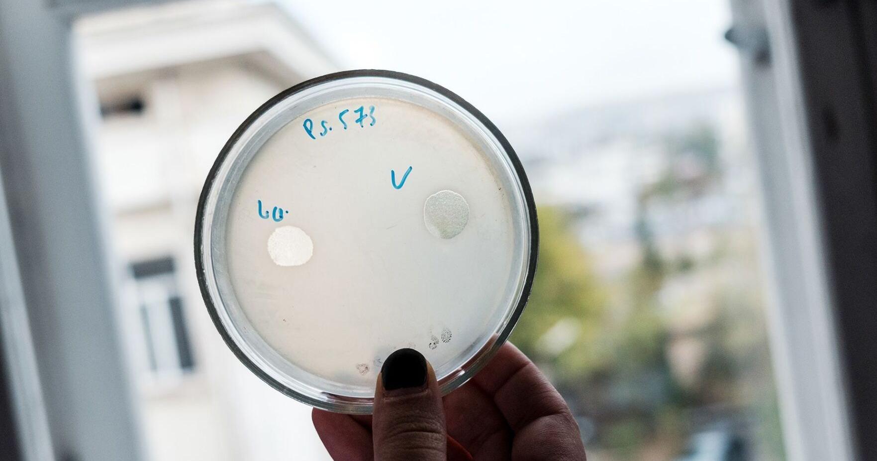 Superbug crisis threatens to kill 10 million per year by 2050. Scientists may have a solution - Vimarsana News
