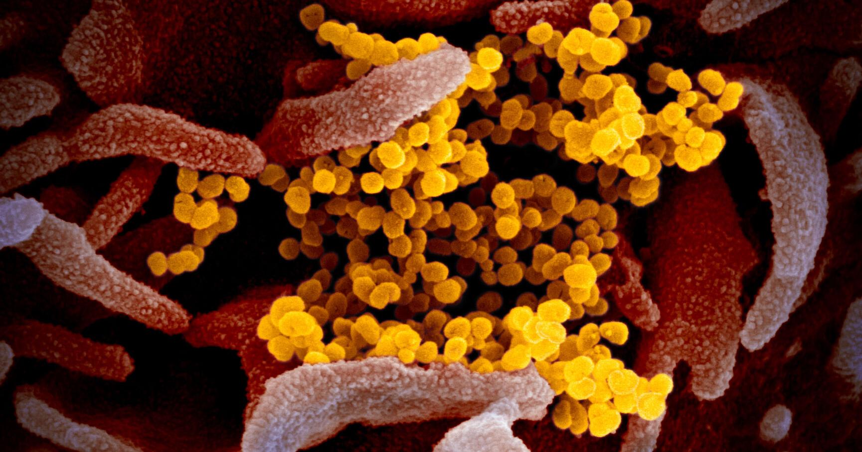 Republican senators ask US intelligence chief for evidence behind latest assessment of Covid-19 pandemic origins - Vimarsana News