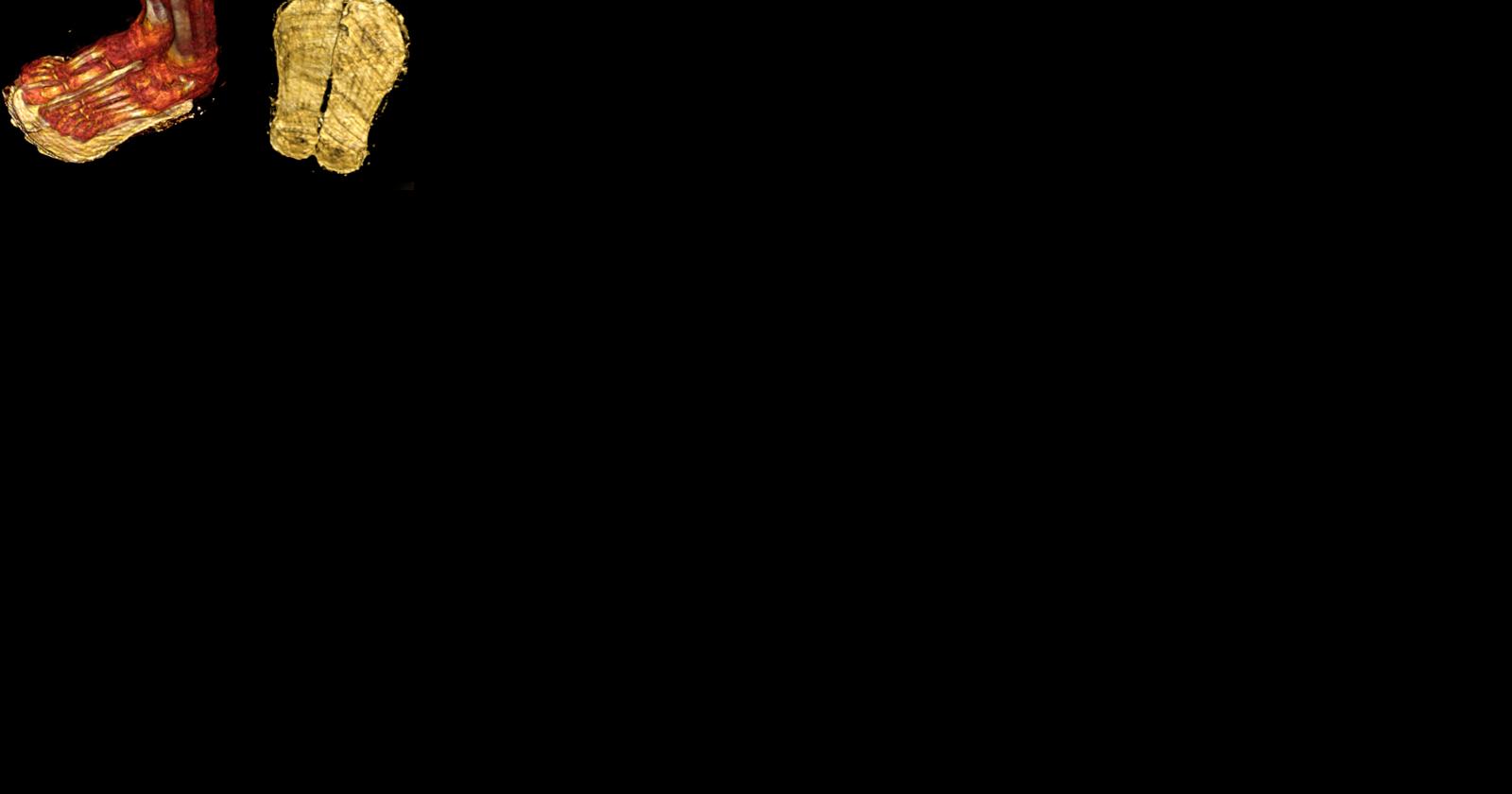 Mummified 'golden boy' found covered in 49 precious amulets - Vimarsana News