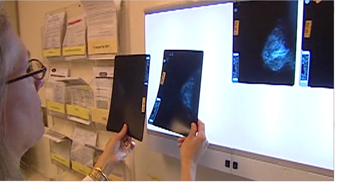 First-of-its-kind blood test screens for over 50 types of cancers ...