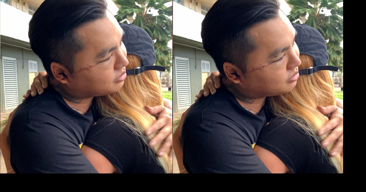 Weekend machete attack leaves Honolulu man fighting for his life