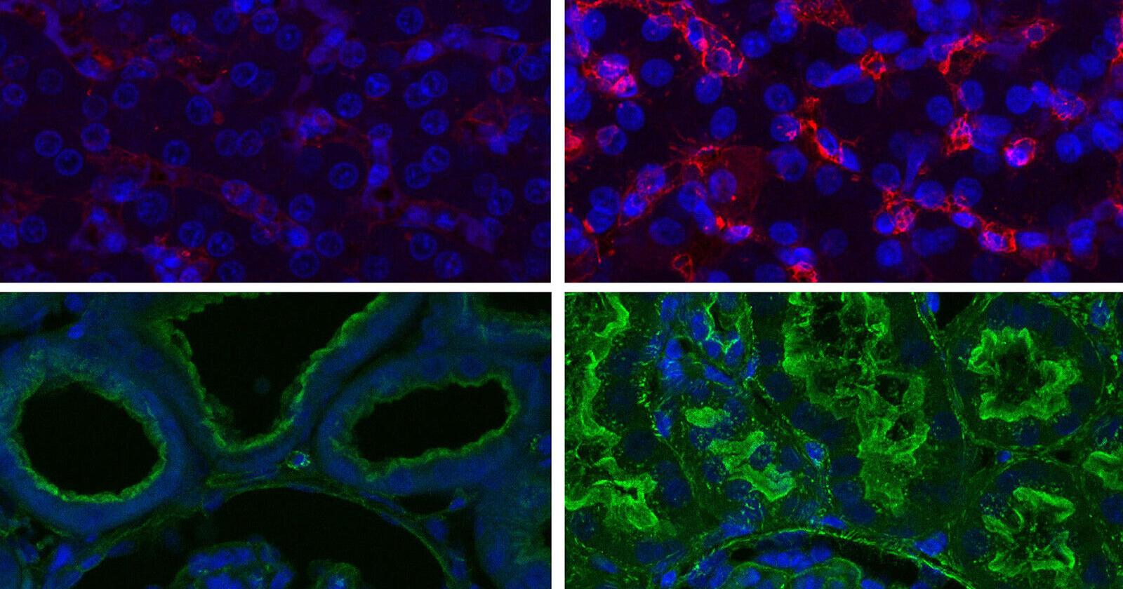 Cell function restored in pigs after death, scientists say - Vimarsana News