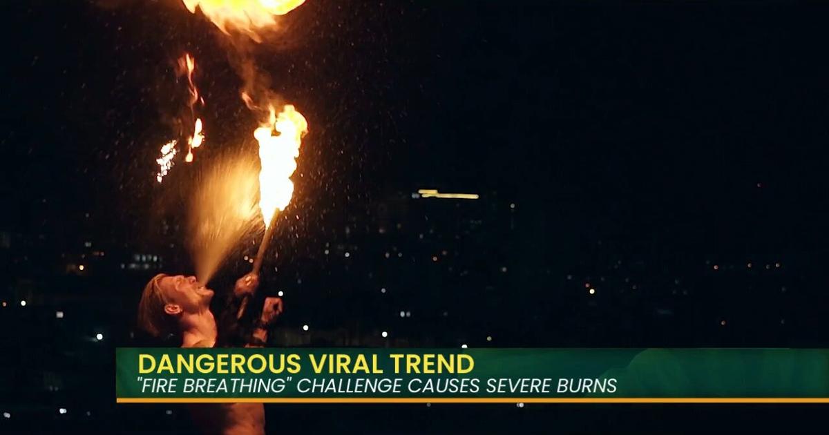 Fire Challenge TikTok Challenge Sends Youth to Hospital | Island Life Live | kitv.com