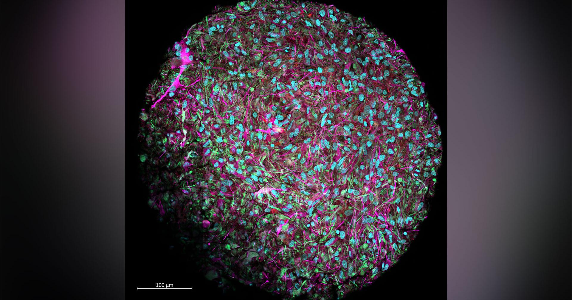 Move over, artificial intelligence. Scientists announce a new 'organoid intelligence' field - Vimarsana News