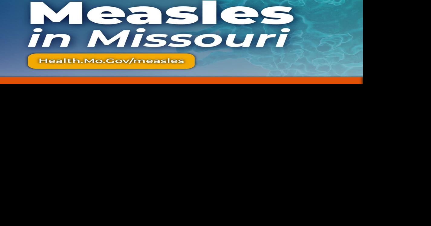 Missouri resident with measles boards Amtrak train in Sedalia
