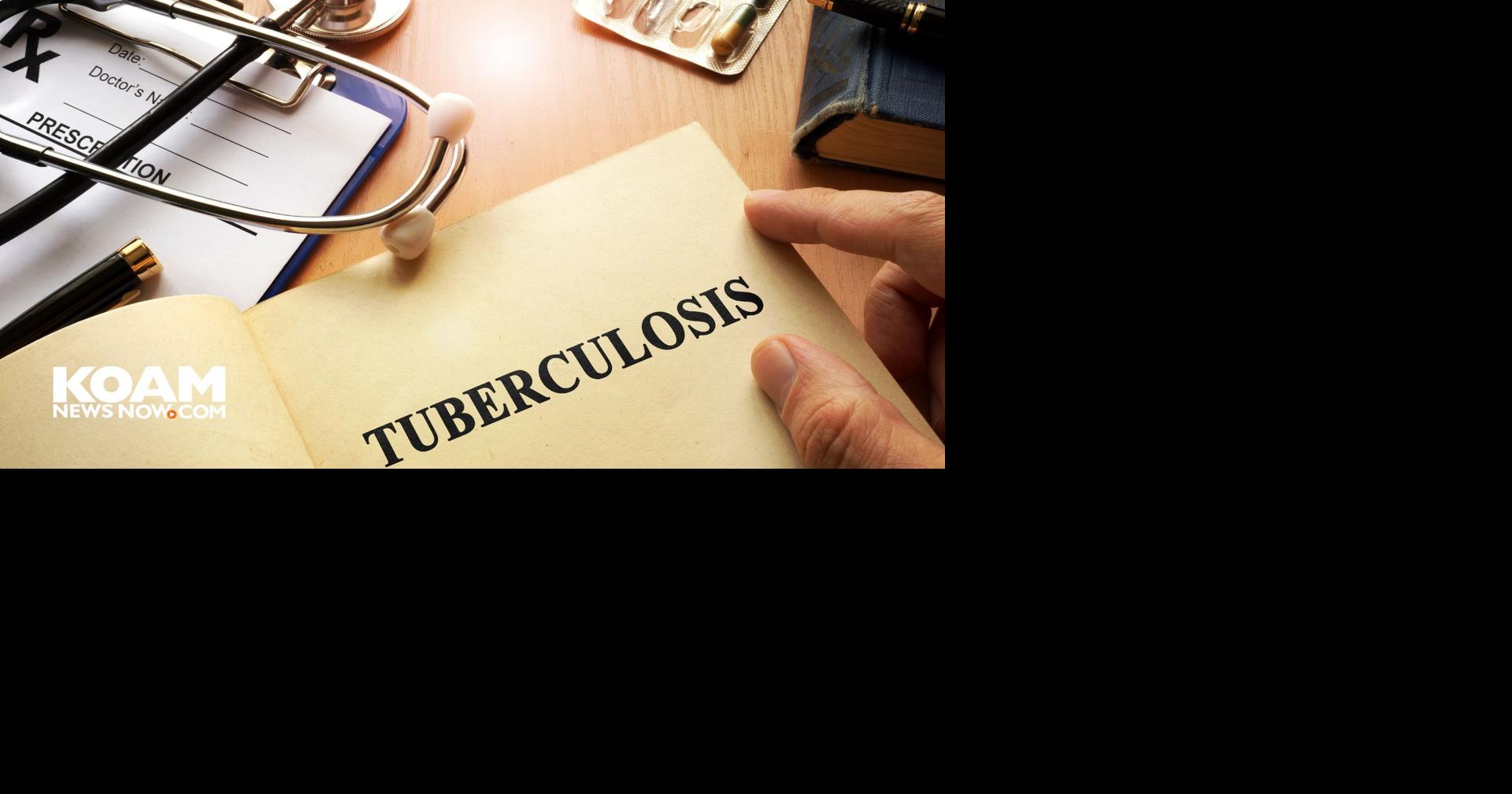 KDHE announces the official end to the Kansas City TB outbreak