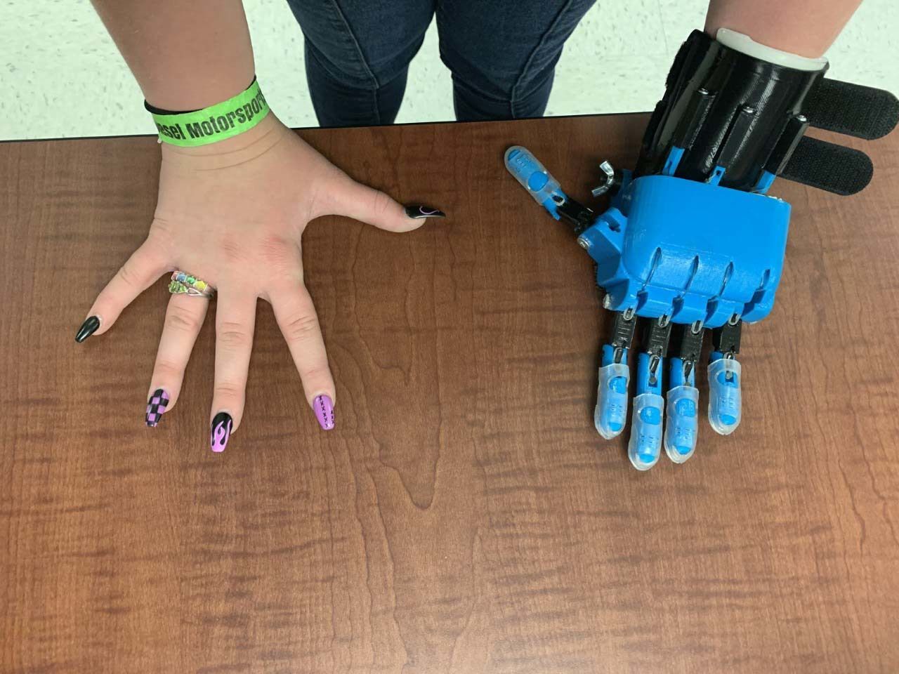 Helping Hands: Trine students design low-cost prosthetic limbs for teens - Vimarsana News