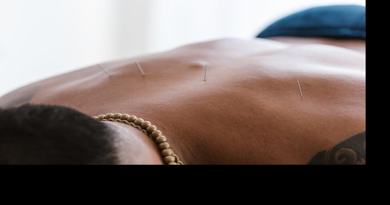 Acupuncture proves to be safe and effective for chronic back pain