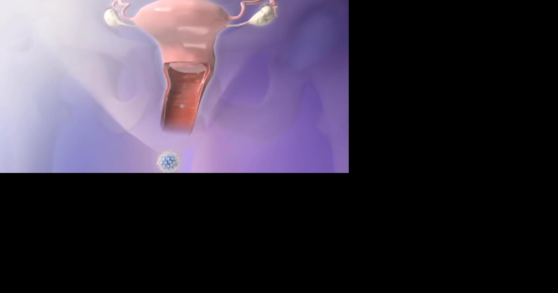 HEALTH MINUTE: HPV MISCONCEPTIONS PUT PEOPLE AT RISK