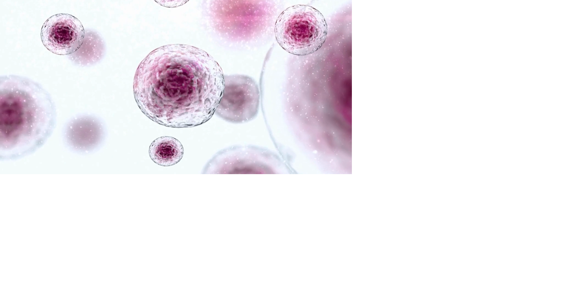 Doctors stress specialized care for Sarcoma as awareness month ends